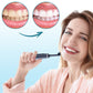 Professional Electric Tooth Polisher Kit